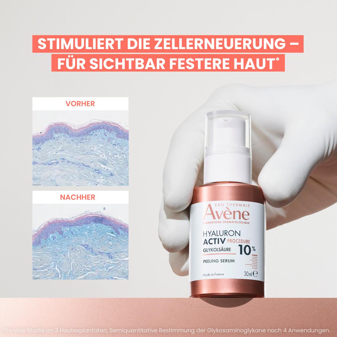 Ergebnisse Peeling Serum - 10 % Glykolsäure