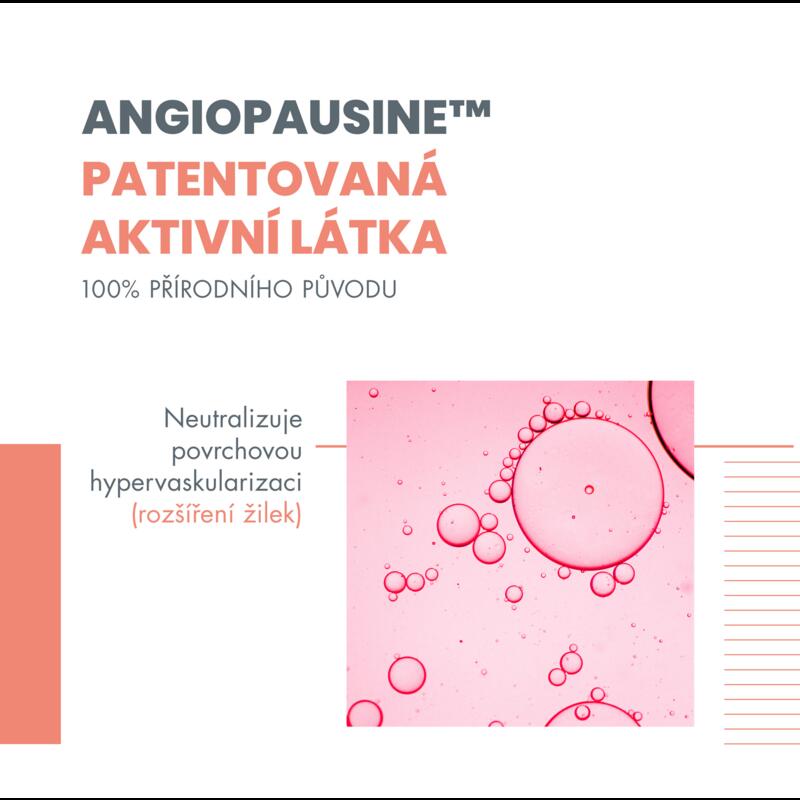 Antirougeurs Rosamed koncentrovaná péče proti chronickému zarudnutí