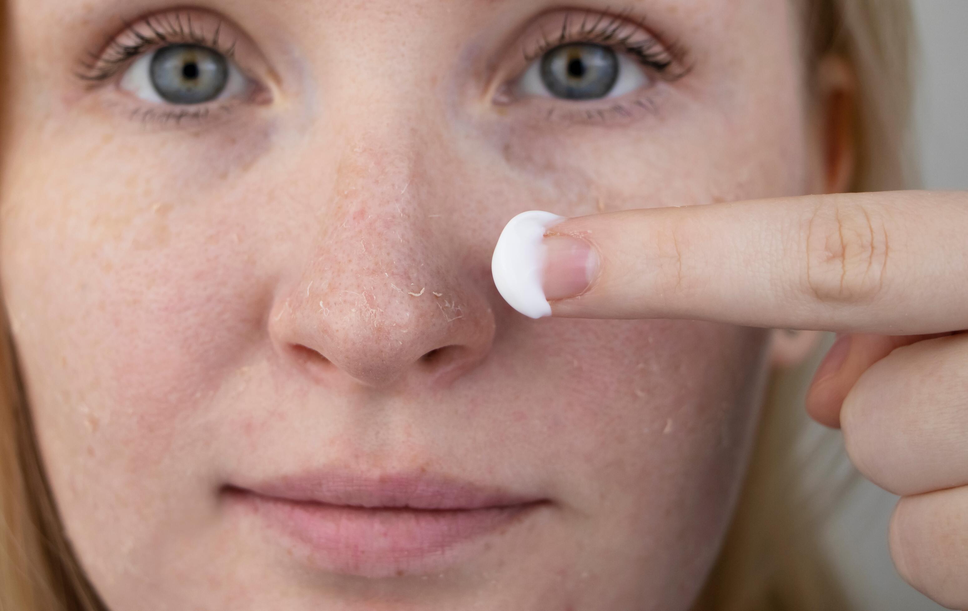 Savon peau sèche