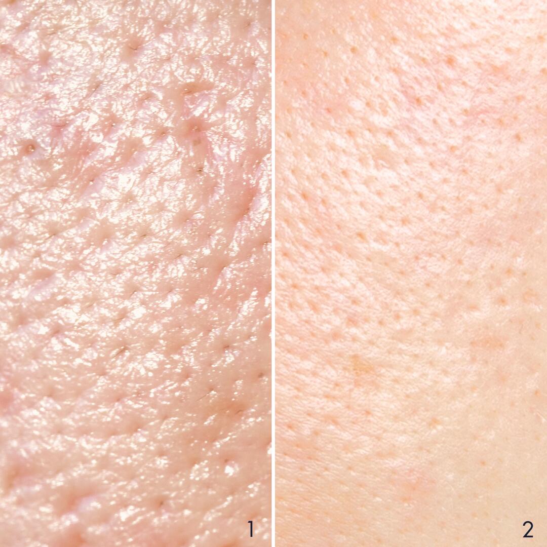 AV_carnets-expert_peau-grasse-vs-peau-mixte_1x1