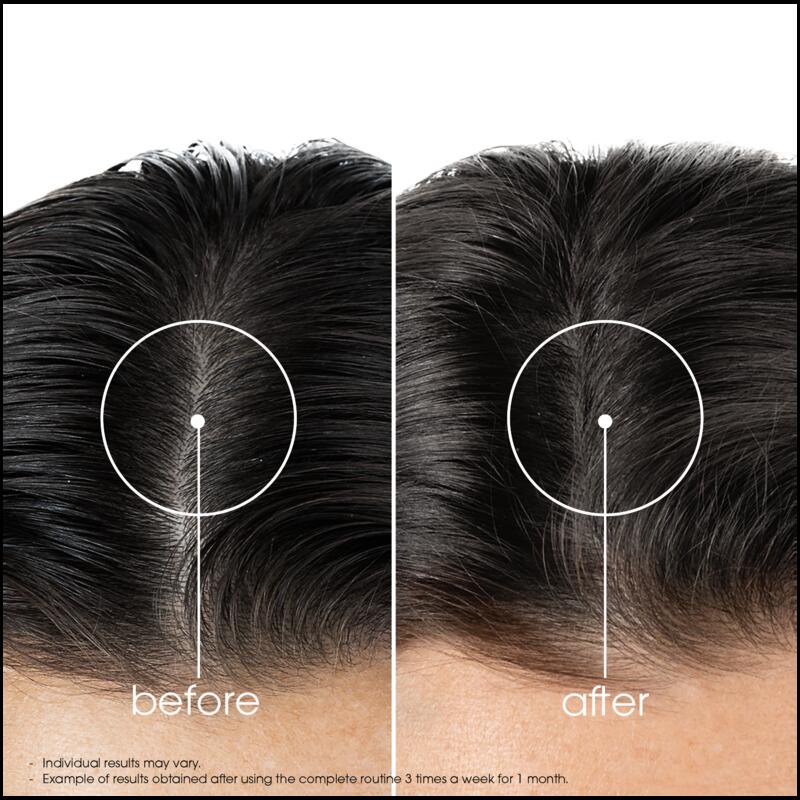 Hair Strengthening Serum for thinning hair