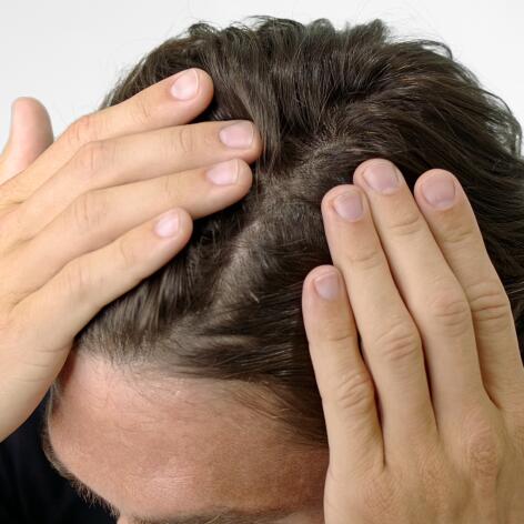 Kahlheit, Alopezie bei Männern ... Haarausfall bei Männern