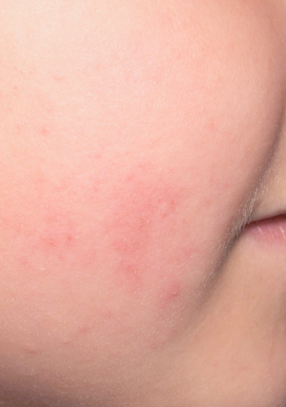 av_votre-peau_cicatrisation_irritations_allergies_visage_4x5_1 473x473