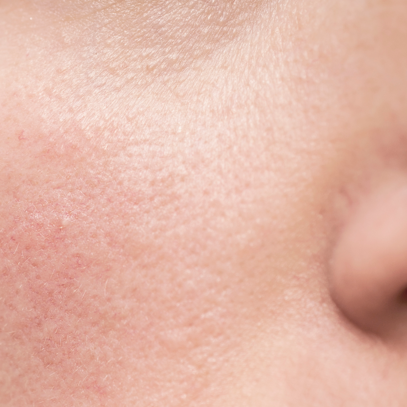 av_votre-peau_cicatrisation_irritations-cutanees_visage_1x1 473x473