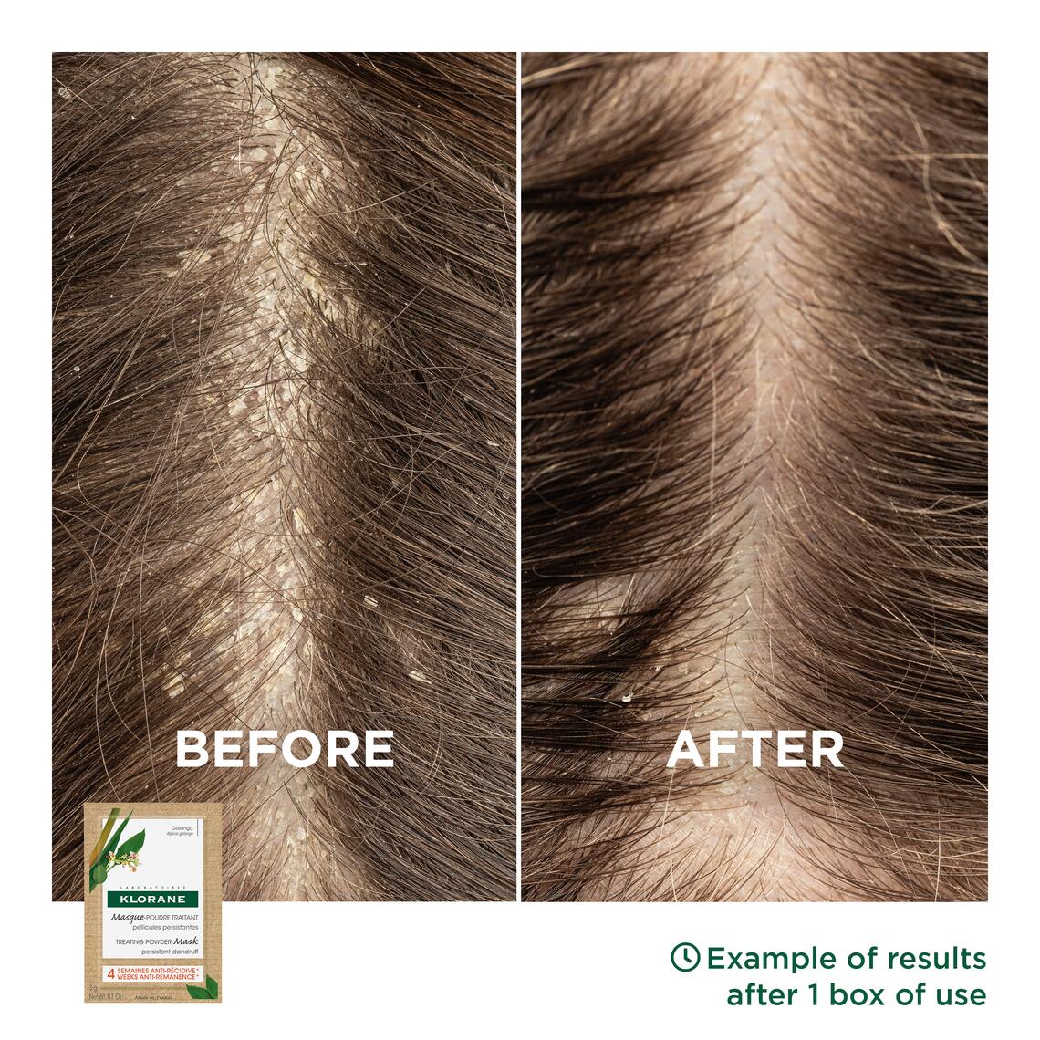 Αποτελέσματα Θεραπεία με Μάσκα σε μορφή Πούδρας με Galanga