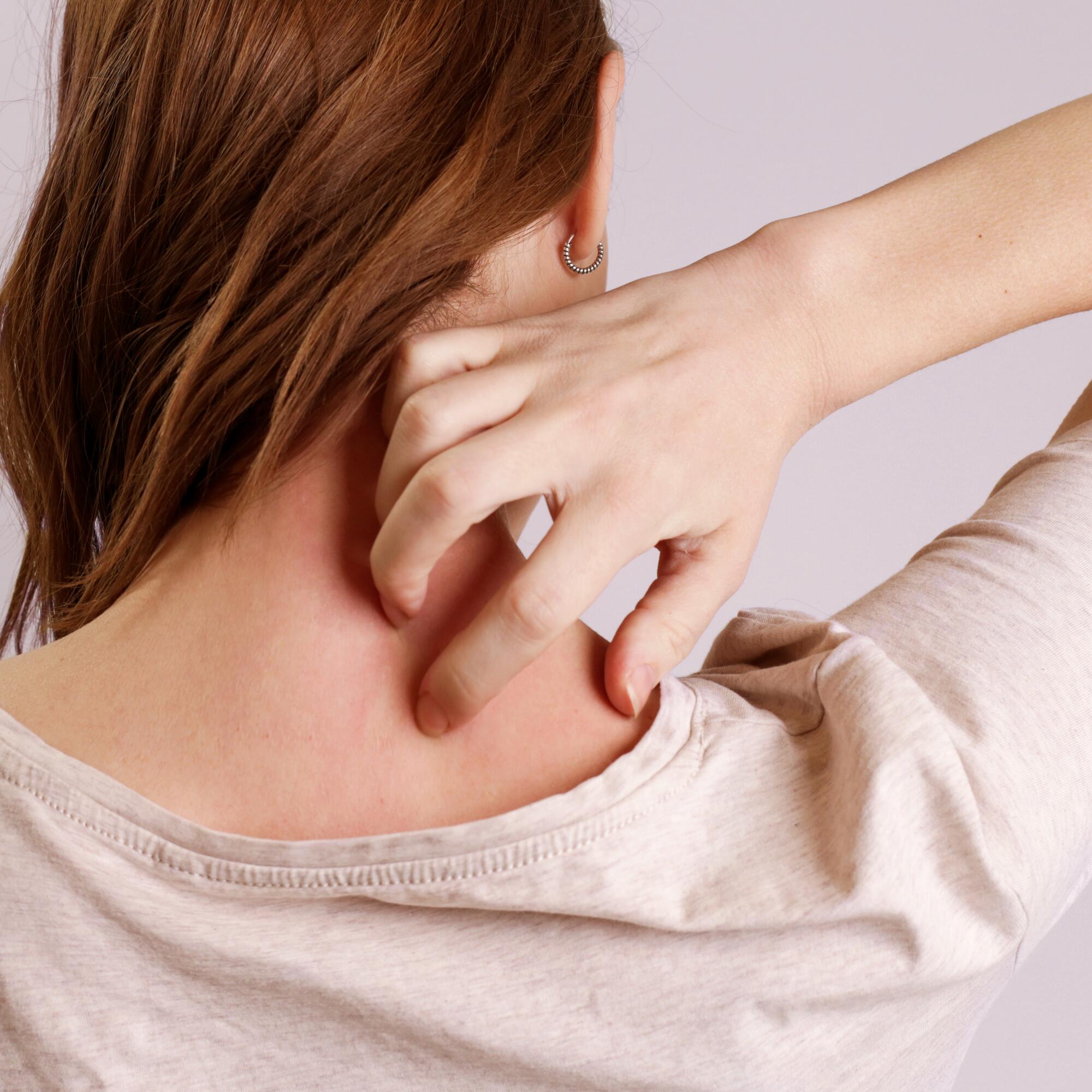 eczema-contact-atopique-difference