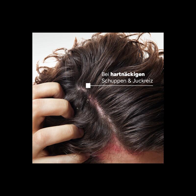 Anti-Schuppen Intensivpflege-Shampoo