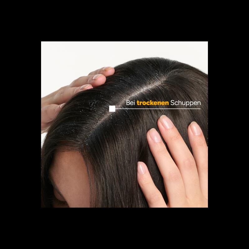DUCRAY - KELUAL SQUANORM Kur-Shampoo Trockene Schuppen