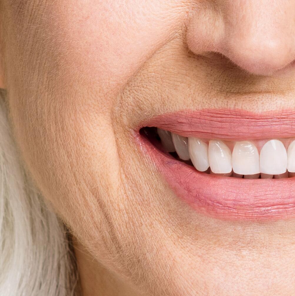 av_anti-age_femme_senior_sourire_rides-nasolabiales_1x1_v1