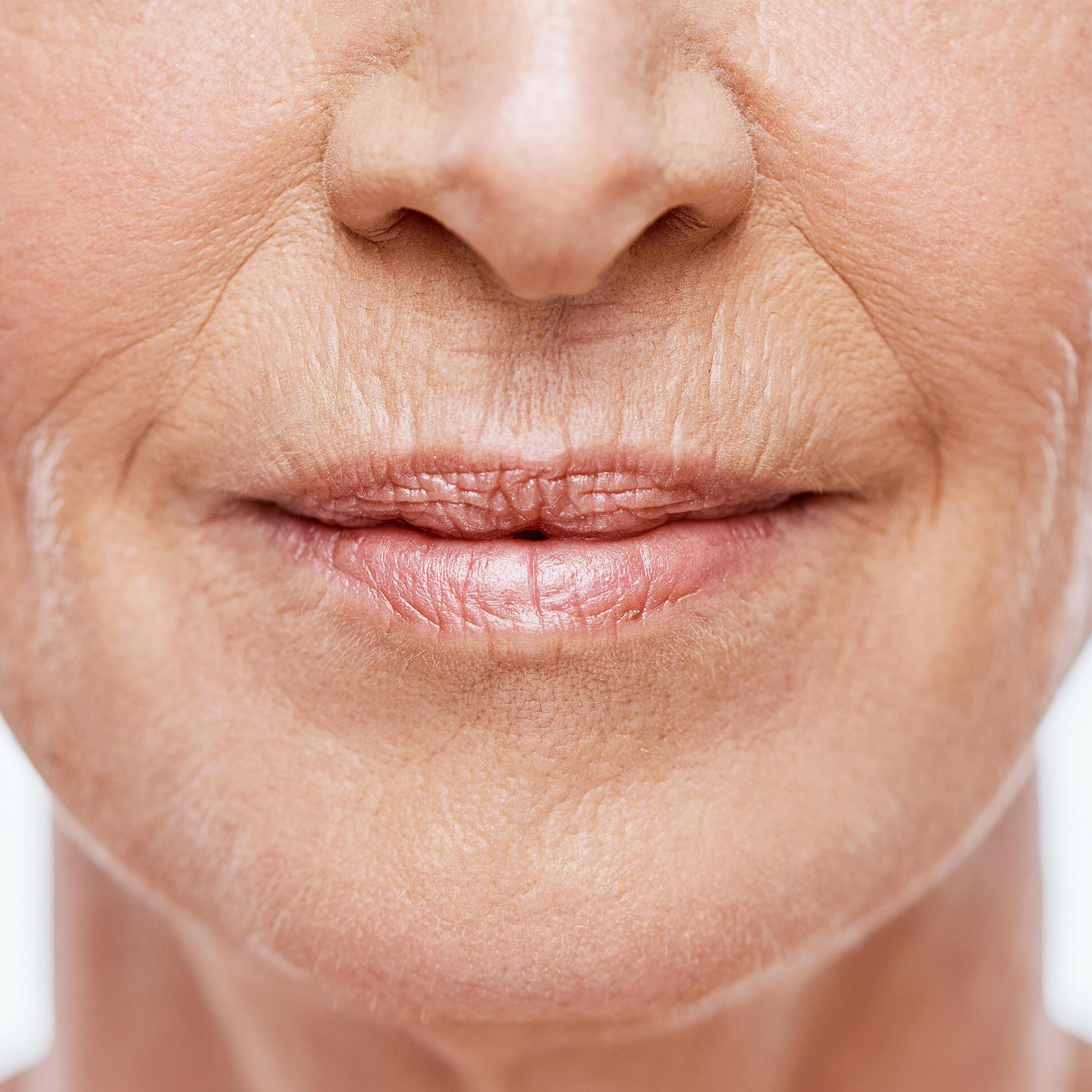 av_anti-age_femme_senior_bouche_rides_1x1_v1