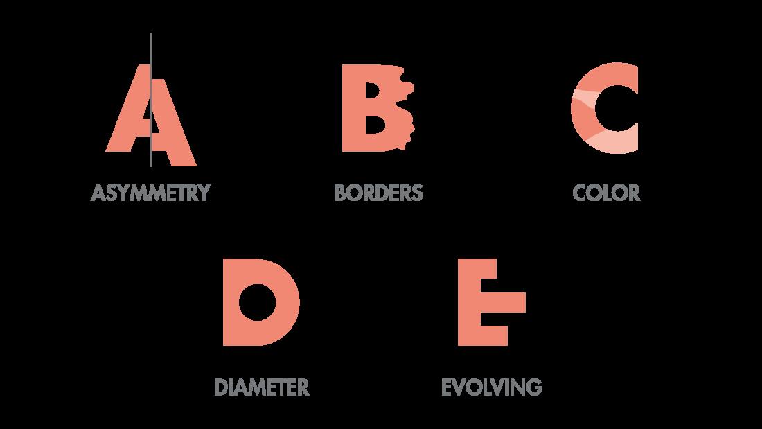 A: Asimmetria- B: Bordi irregolari- C: Colore non uniforme o variegato- D: Diametro maggiore di 6 mm- E: Evoluzione

