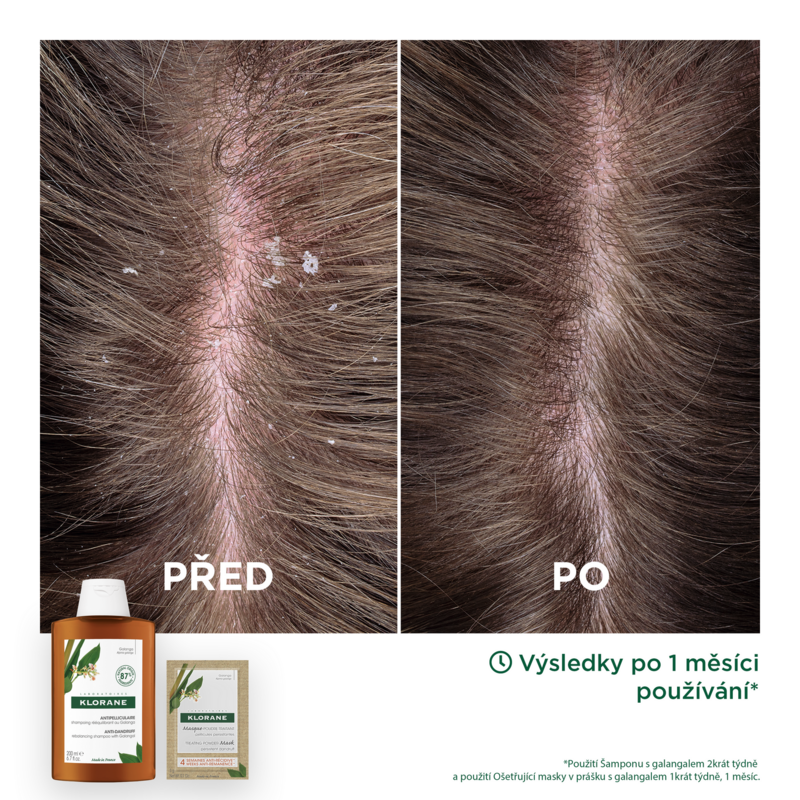 Šampon proti lupům s galangalem - pro obnovení rovnováhy
