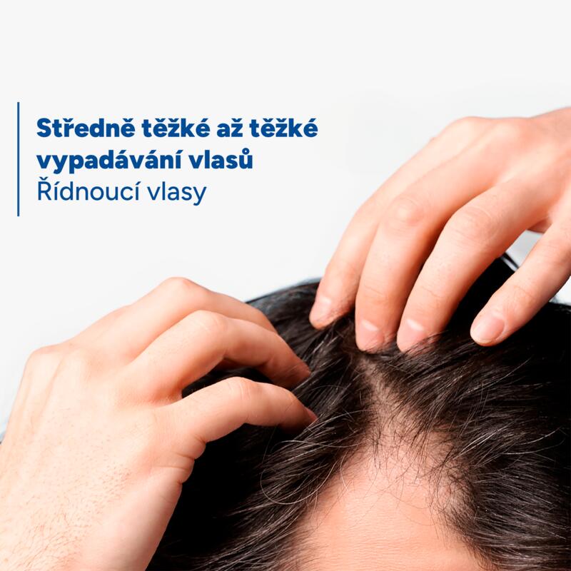 Sérum proti vypadávání vlasů a pro jejich ukotvení