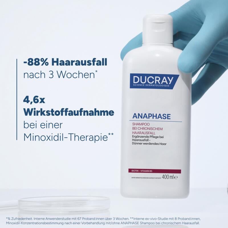 Shampoo bei chronischem Haarausfall