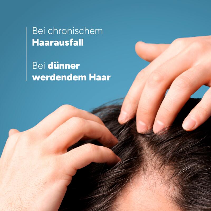Shampoo bei chronischem Haarausfall