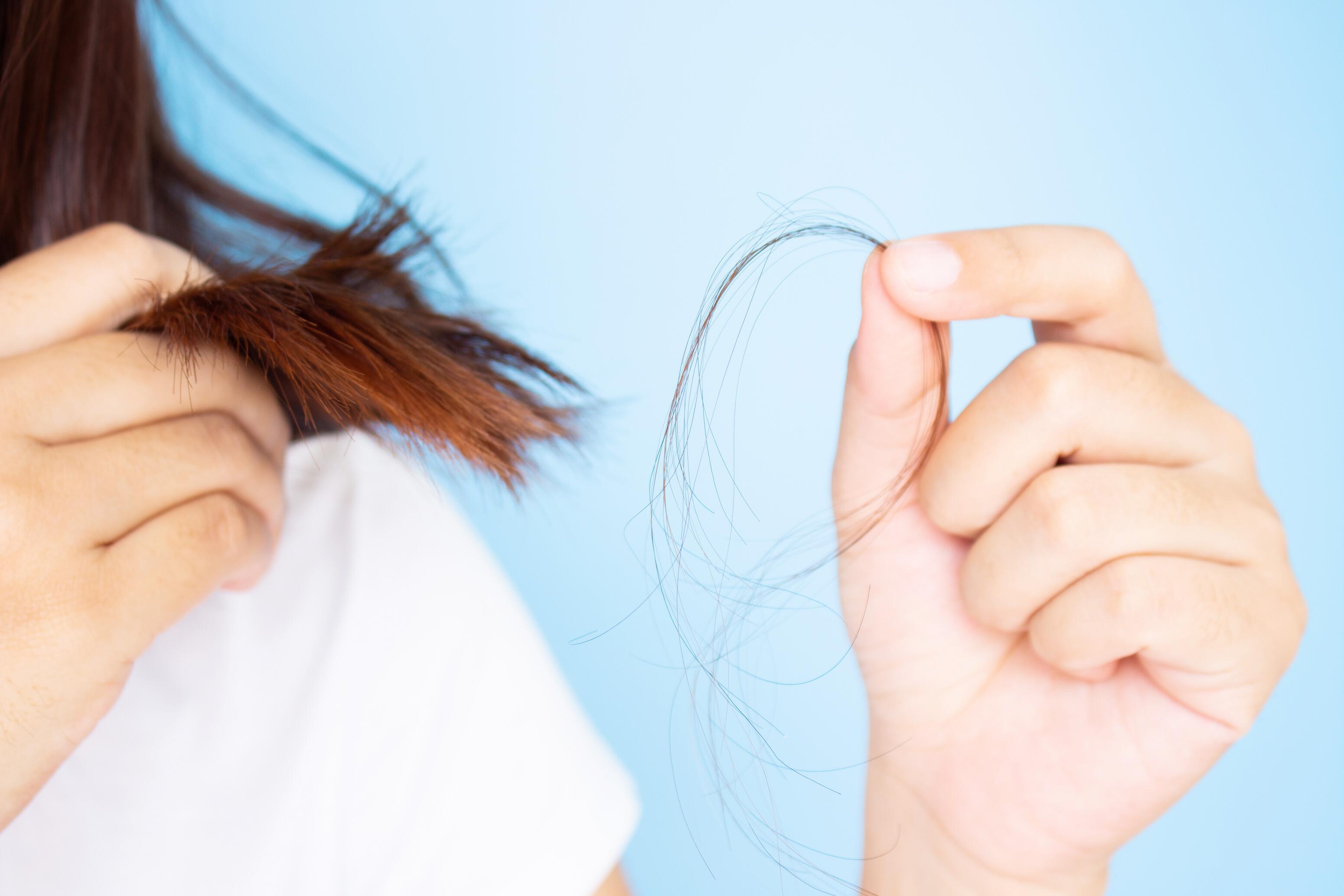 du_article_hair-loss-women_header