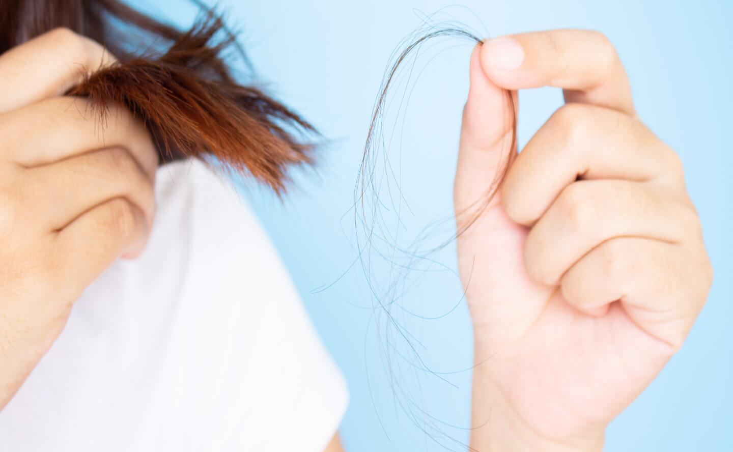 du_article_hair-loss-women_header
