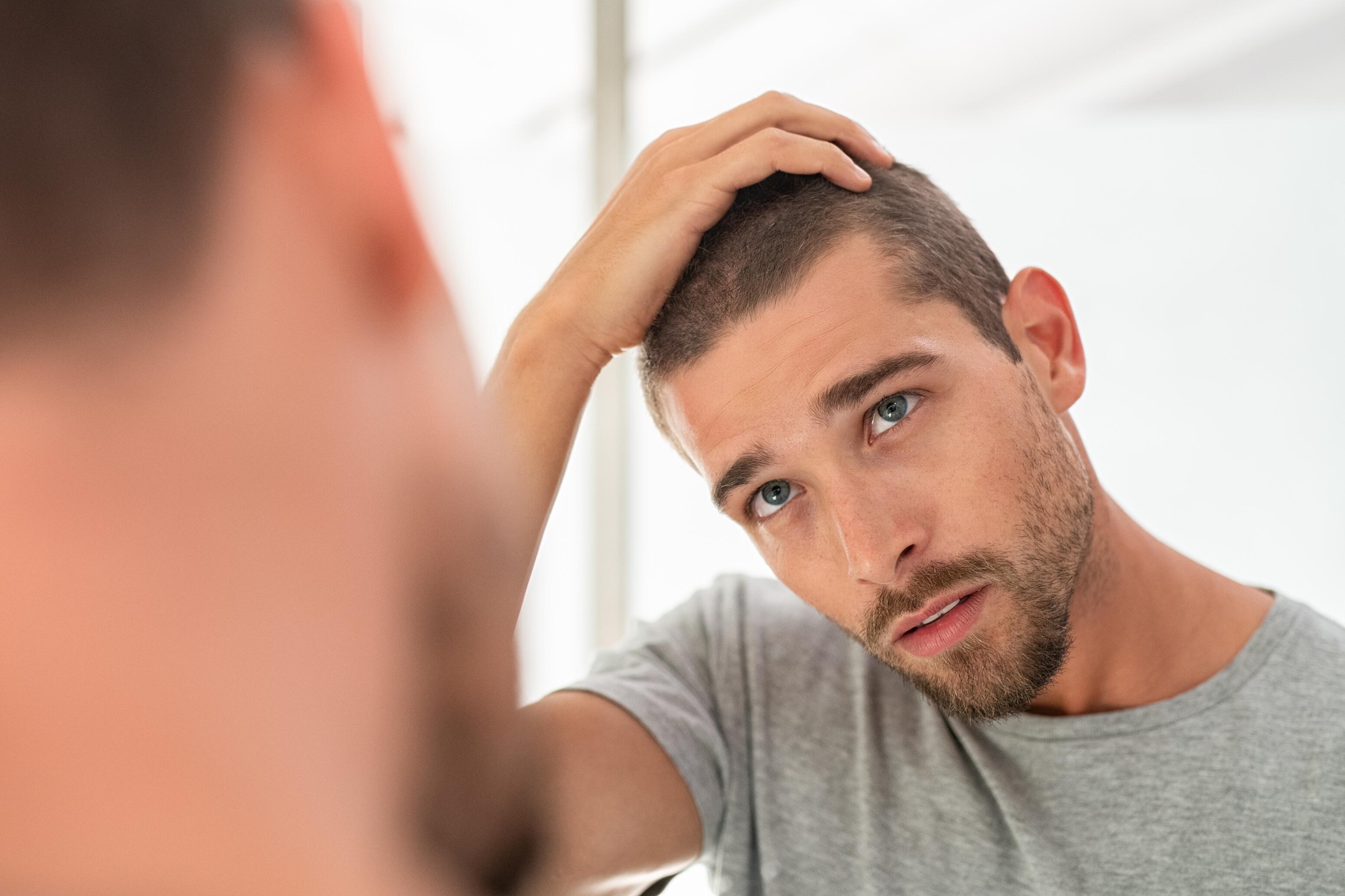 du_article_hair-loss-men_header