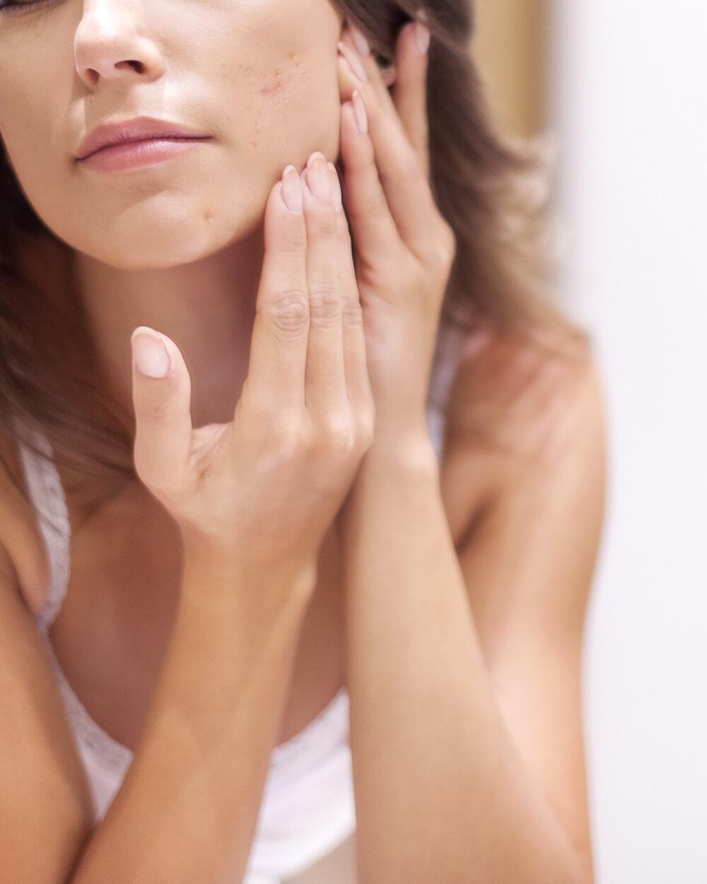 <p><a href="/a-sua-pele/pele-oleosa-com-tendencia-para-manchas-e-acne/o-que-e-pele-com-tendencia-acneica/acne-adulta-causas-e-cuidados">Acne de adulto</a></p>

