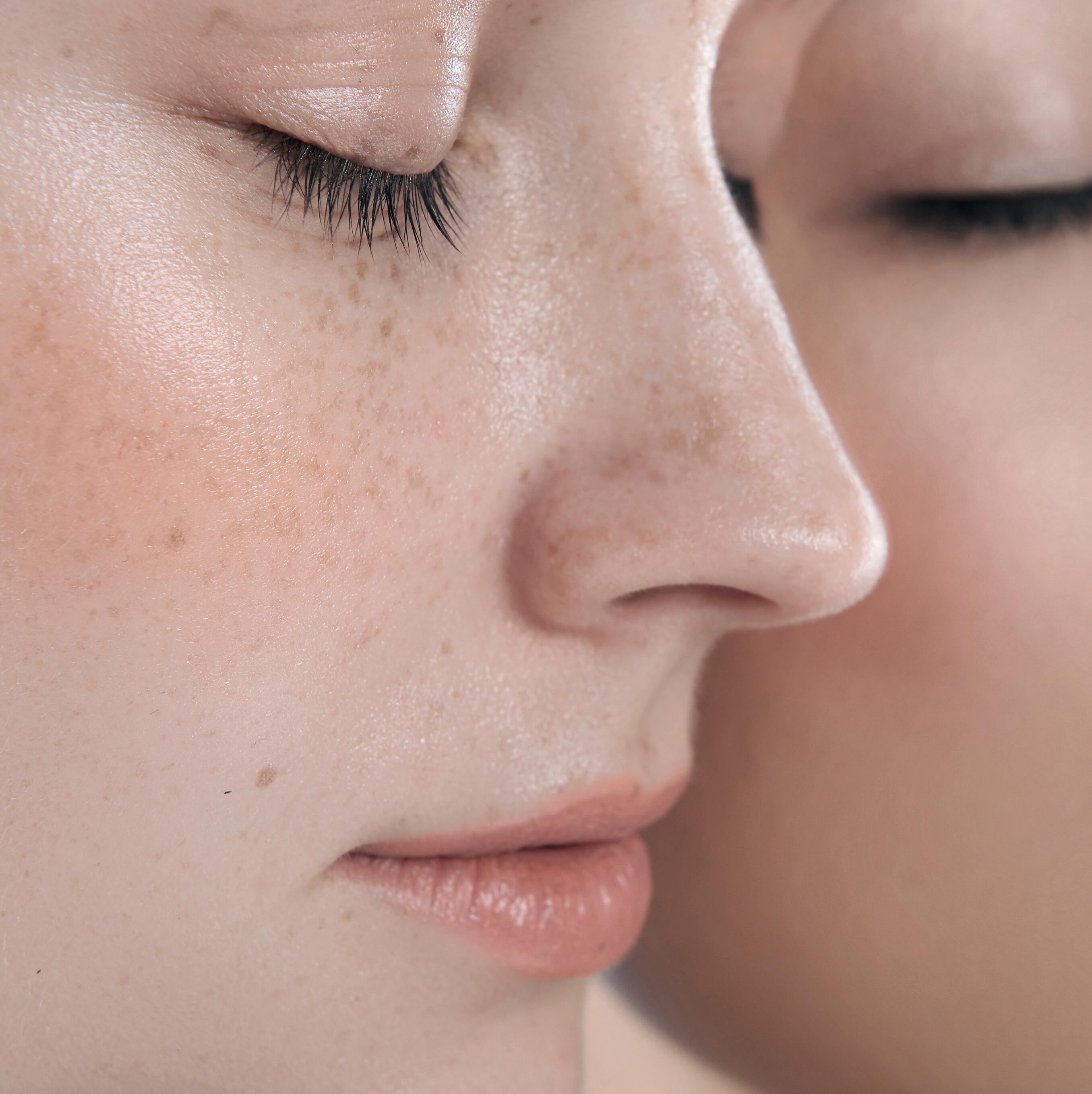 AD_ROSACEA_WOMEN-EYES-CLOSED_SQUARE_2021 472x472