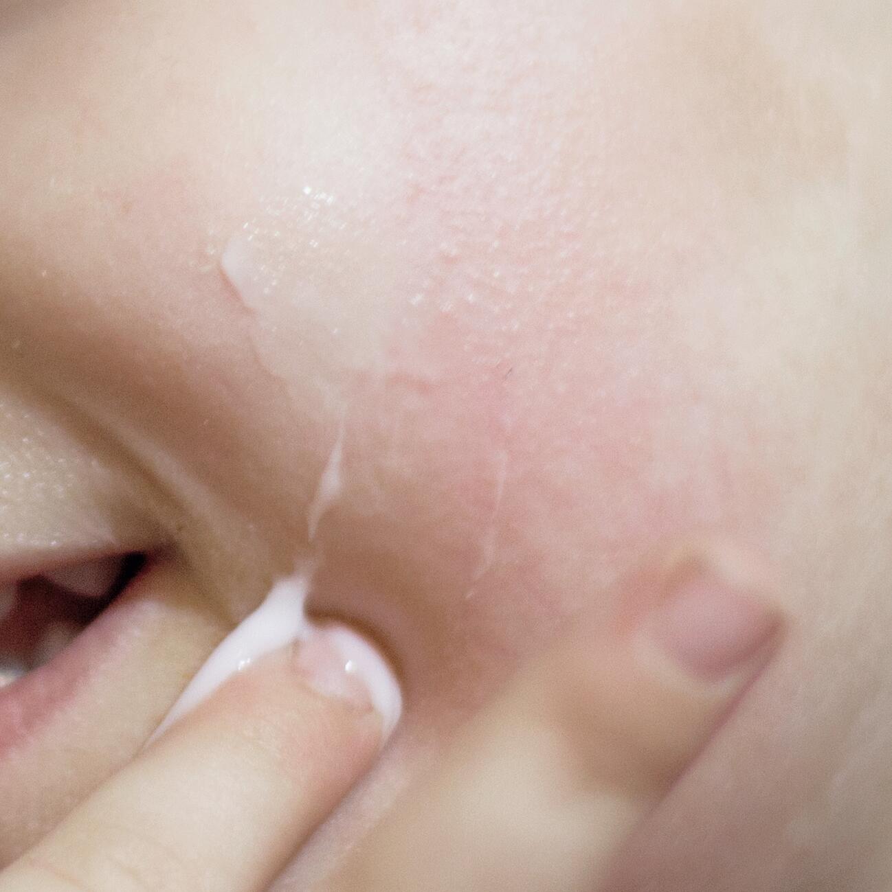 AD_IRRITATIONS_CHILD-IRRITATED-CHEEK-CREAM_SQUARE_2021