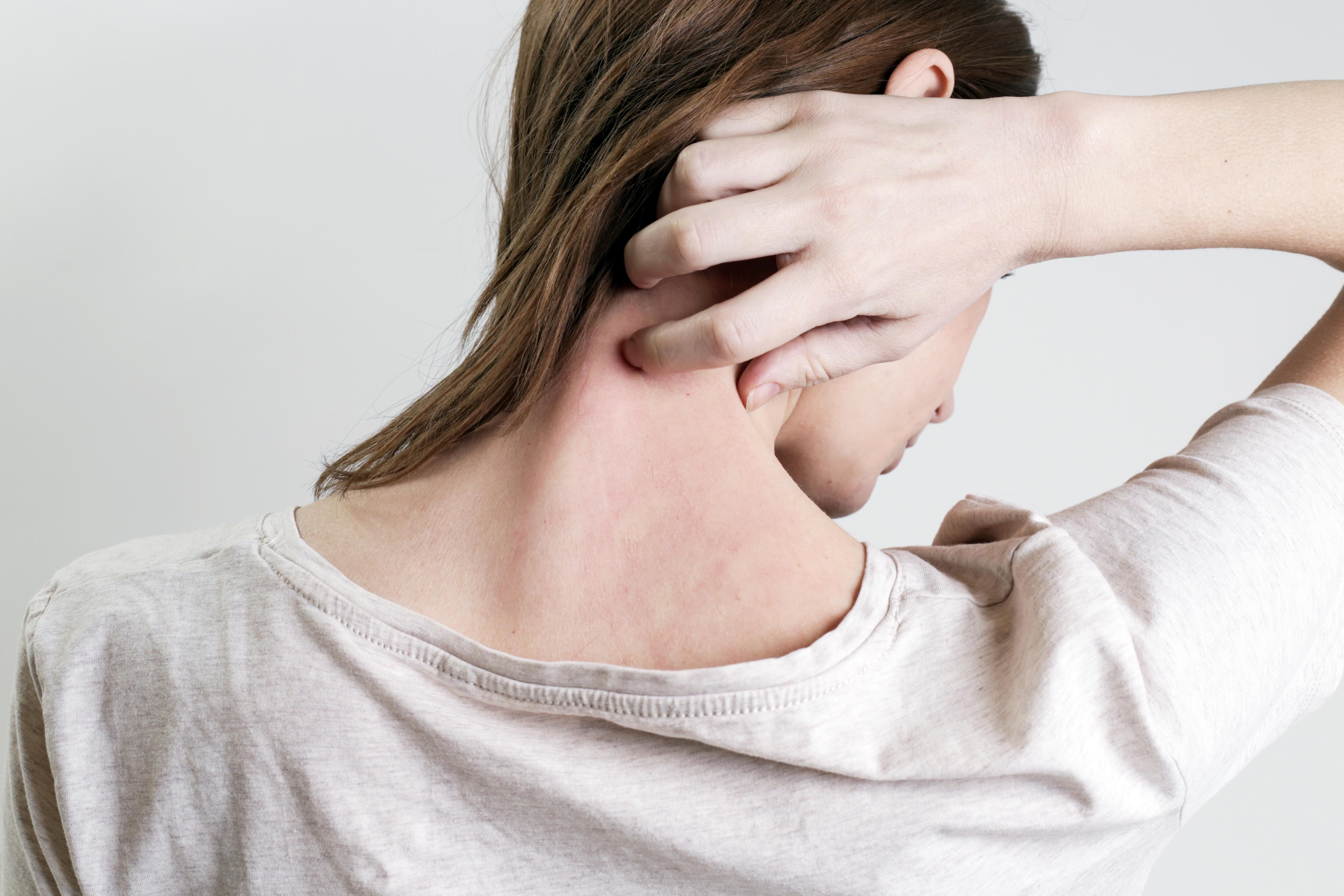AD_ATOPIC-SKIN_WOMAN-SCRATCHING-ITCHING-NECK_LARGE_2021