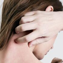 AD_ATOPIC-SKIN_WOMAN-SCRATCHING-ITCHING-NECK_LARGE_2021