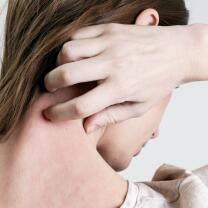 AD_ATOPIC-SKIN_WOMAN-SCRATCHING-ITCHING-NECK_LARGE_2021