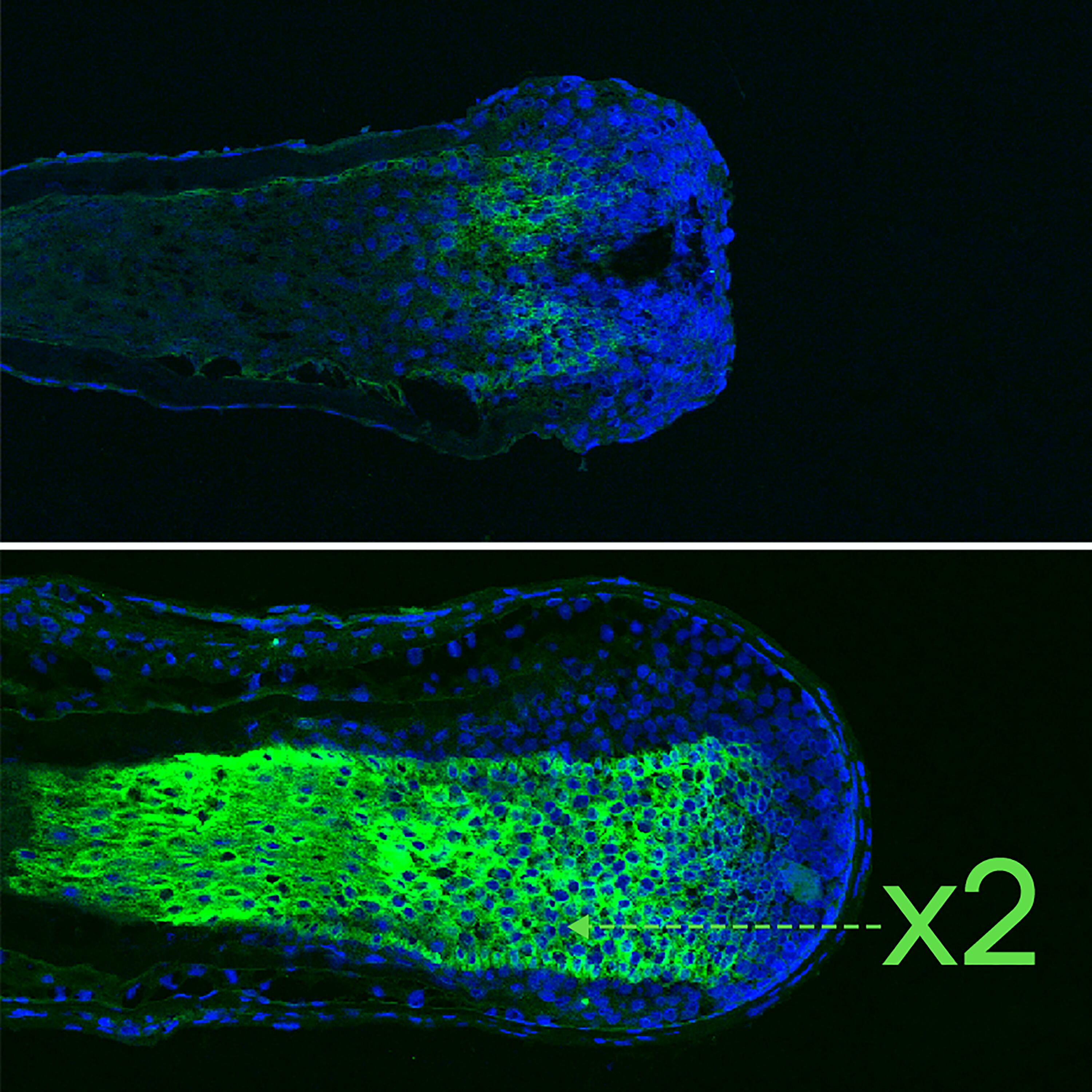 RF_Triphasic-reactional_Hair-microscope-keratin_Website_24