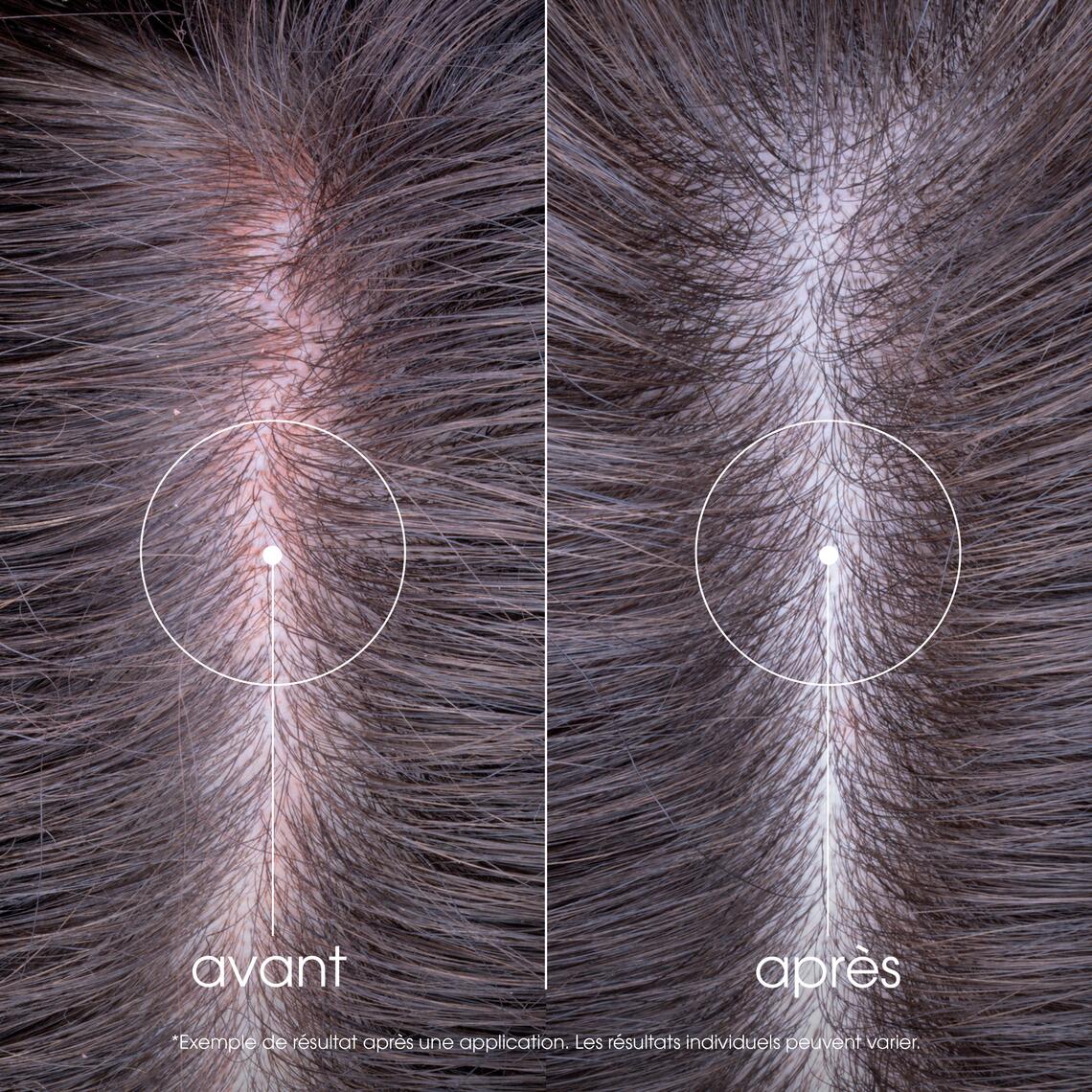 Résultats Après-shampooing apaisant à la Pivoine BIO