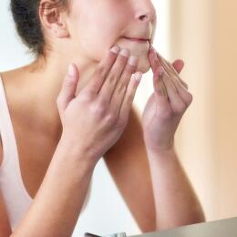 Cuidando da pele com tendência à acne em adolescentes