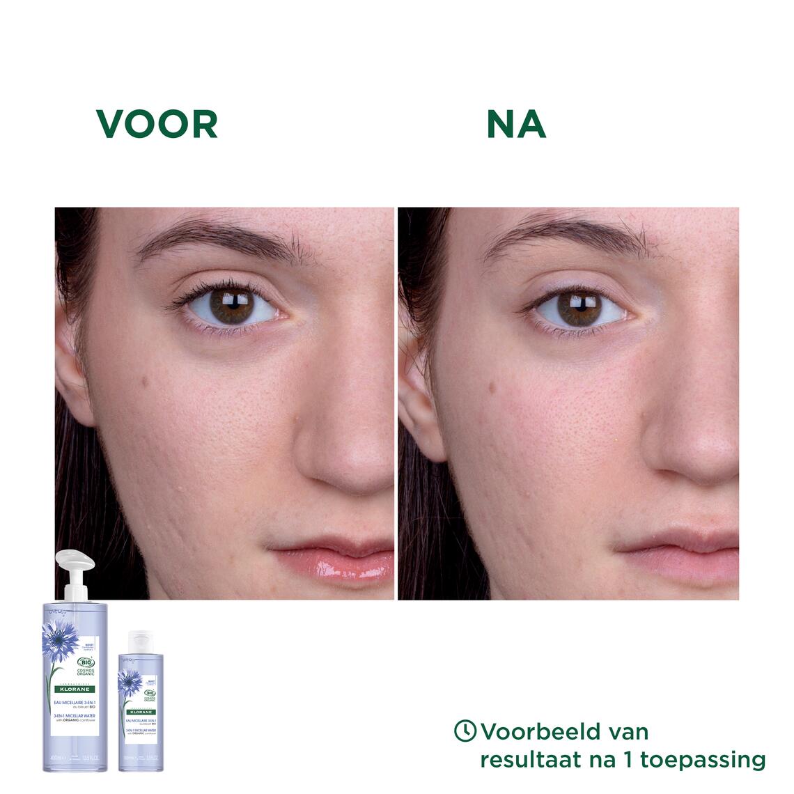 Resultaten BIO 3-in-1 micellair water met korenbloem - Gezicht, ogen