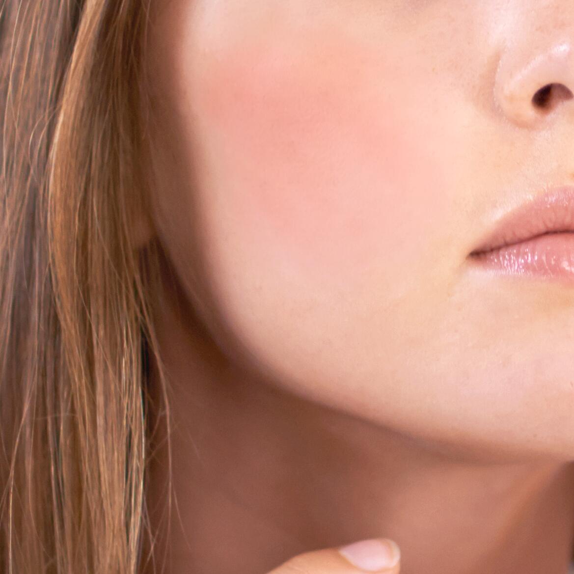 av_peaux-sensibles_joue-rouge_1x1 472x472