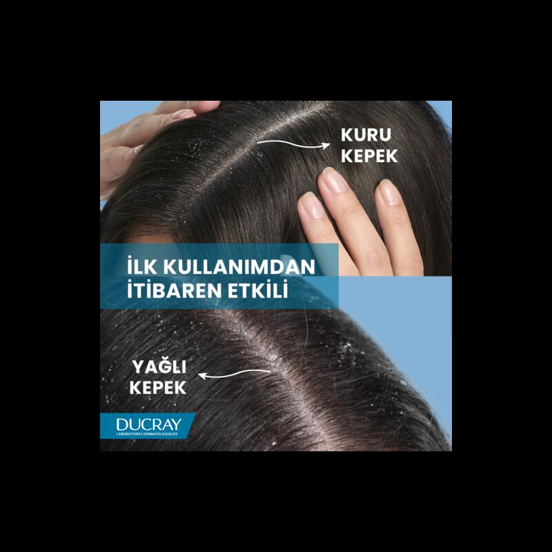 Kepek Karşıtı Losyon