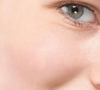 av_carnets-experts_peau-intolerante-3_1x1