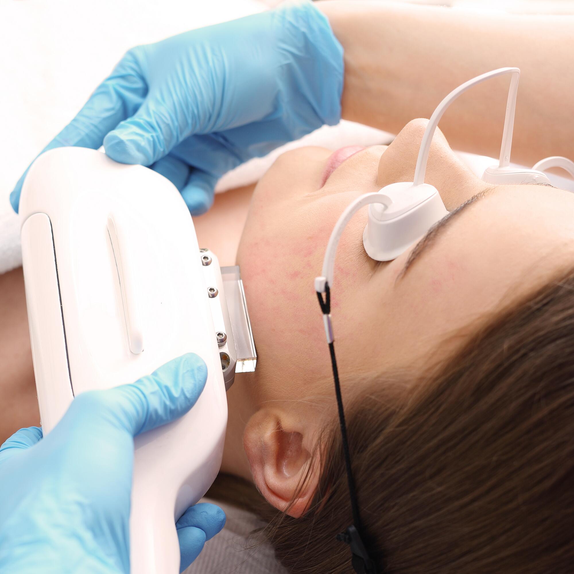 av_acne_soin-visage_1x1