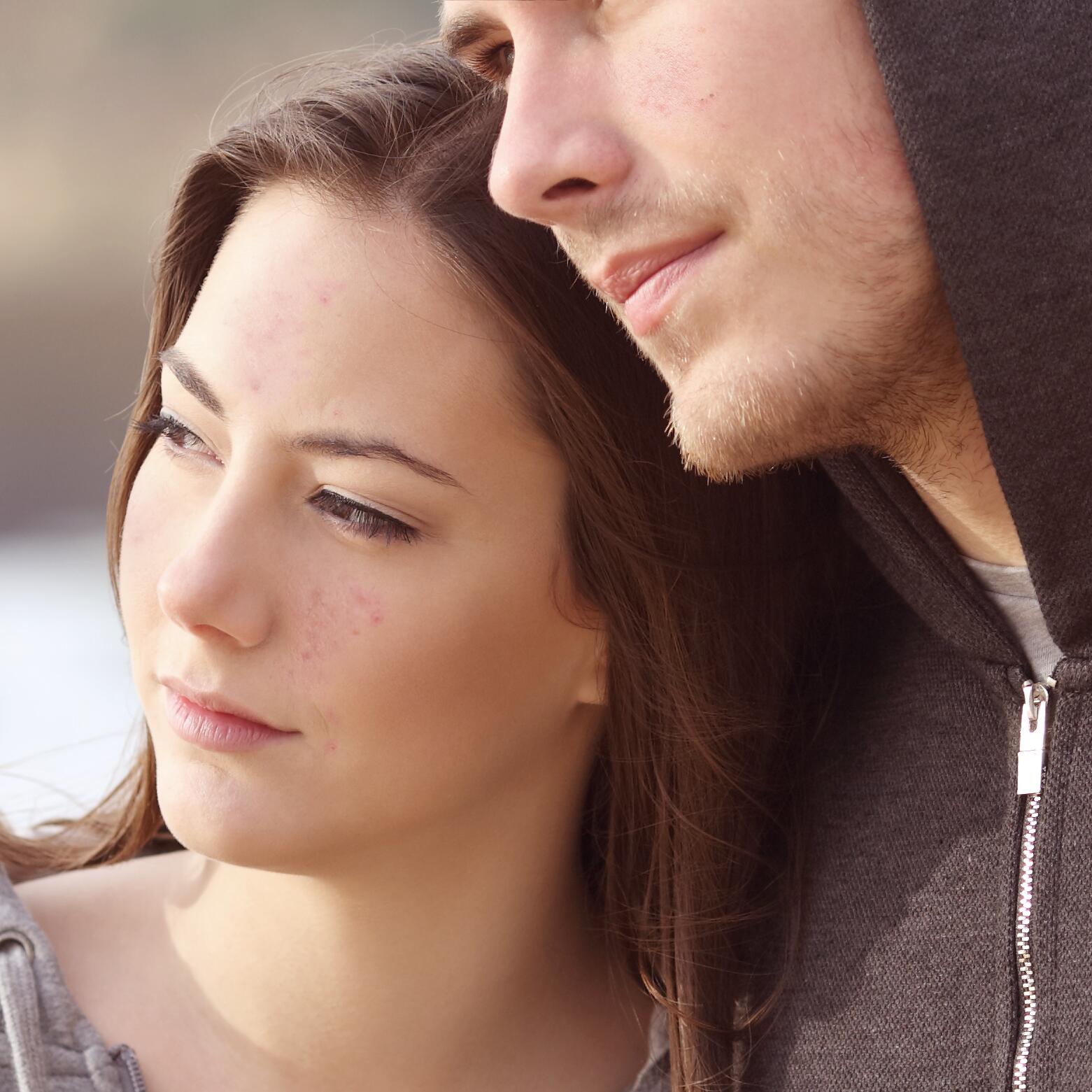 Factores agravantes del acné