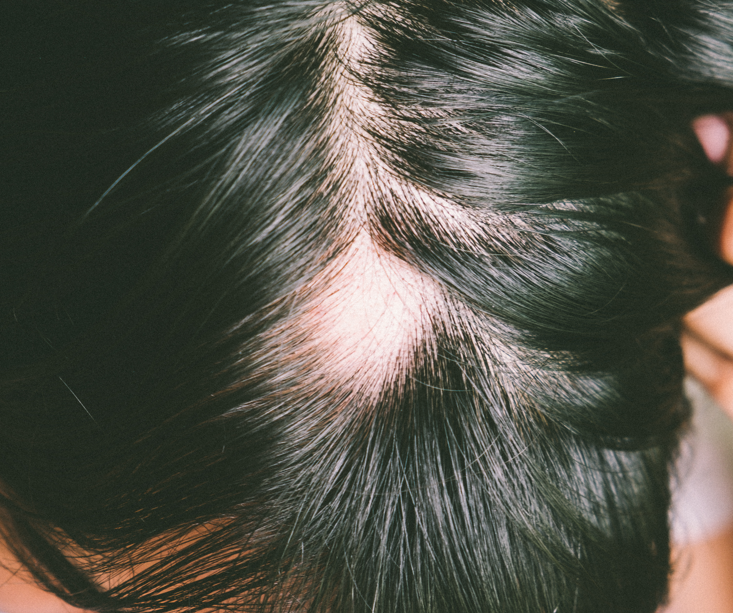 Perte de cheveux et Croutes de lait. QUOI FAIRE?, Routine capillaire  cheveux crépus pour enfants
