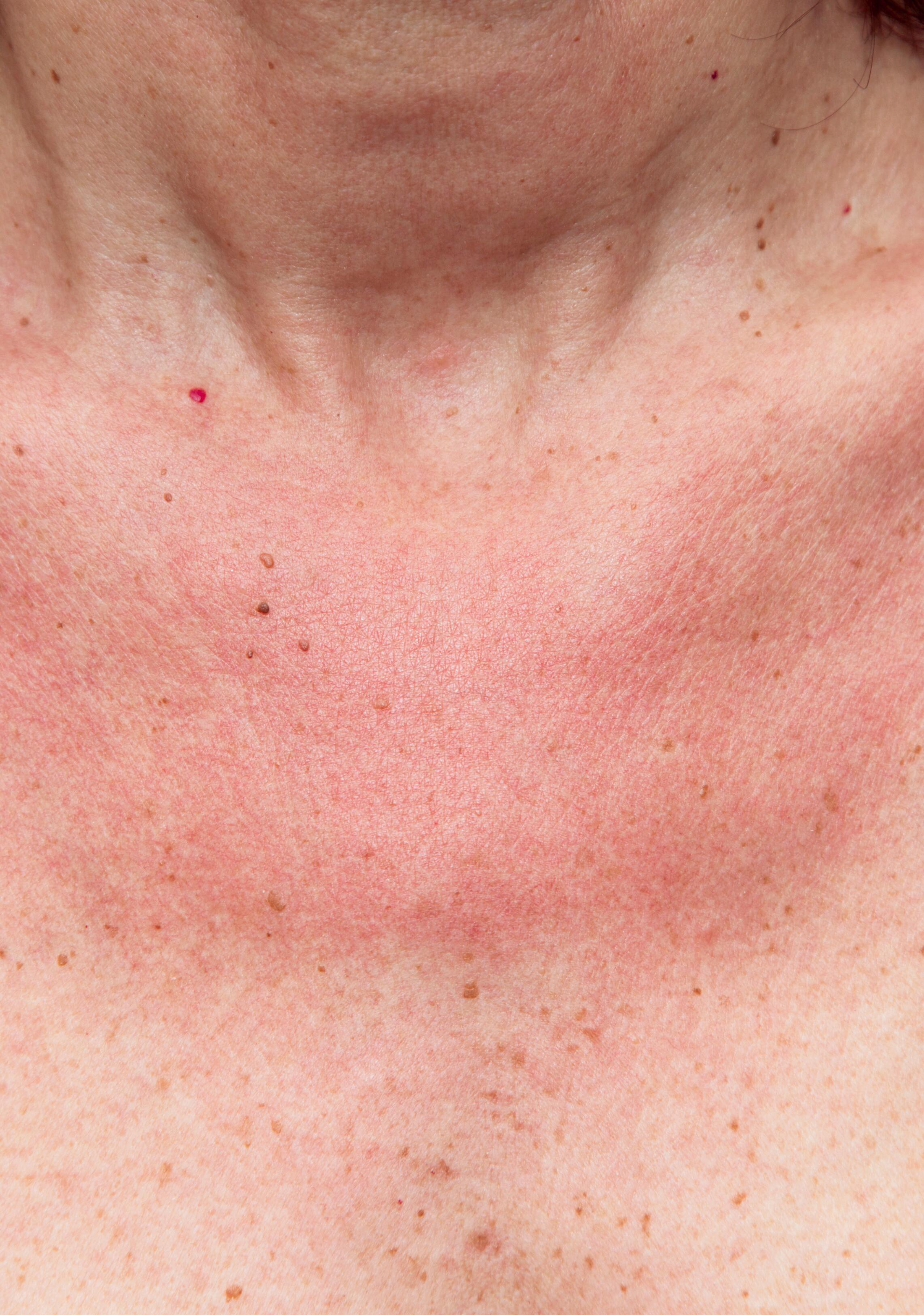 <span class="ezstring-field">av_solaires_lucite_estival_4x5_2025x2880</span>