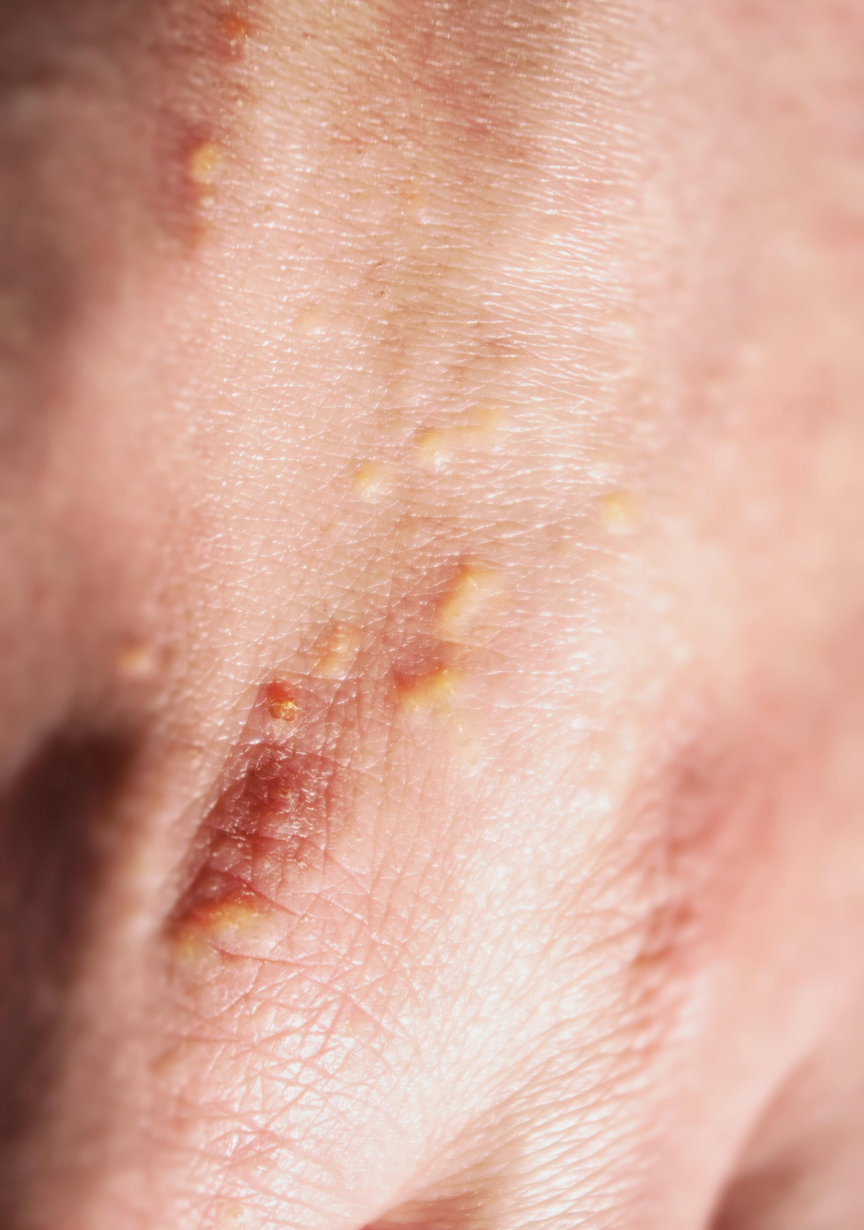 <span class="ezstring-field">av_solaires_lucite-polymorphe_4x5_2025x2880</span>