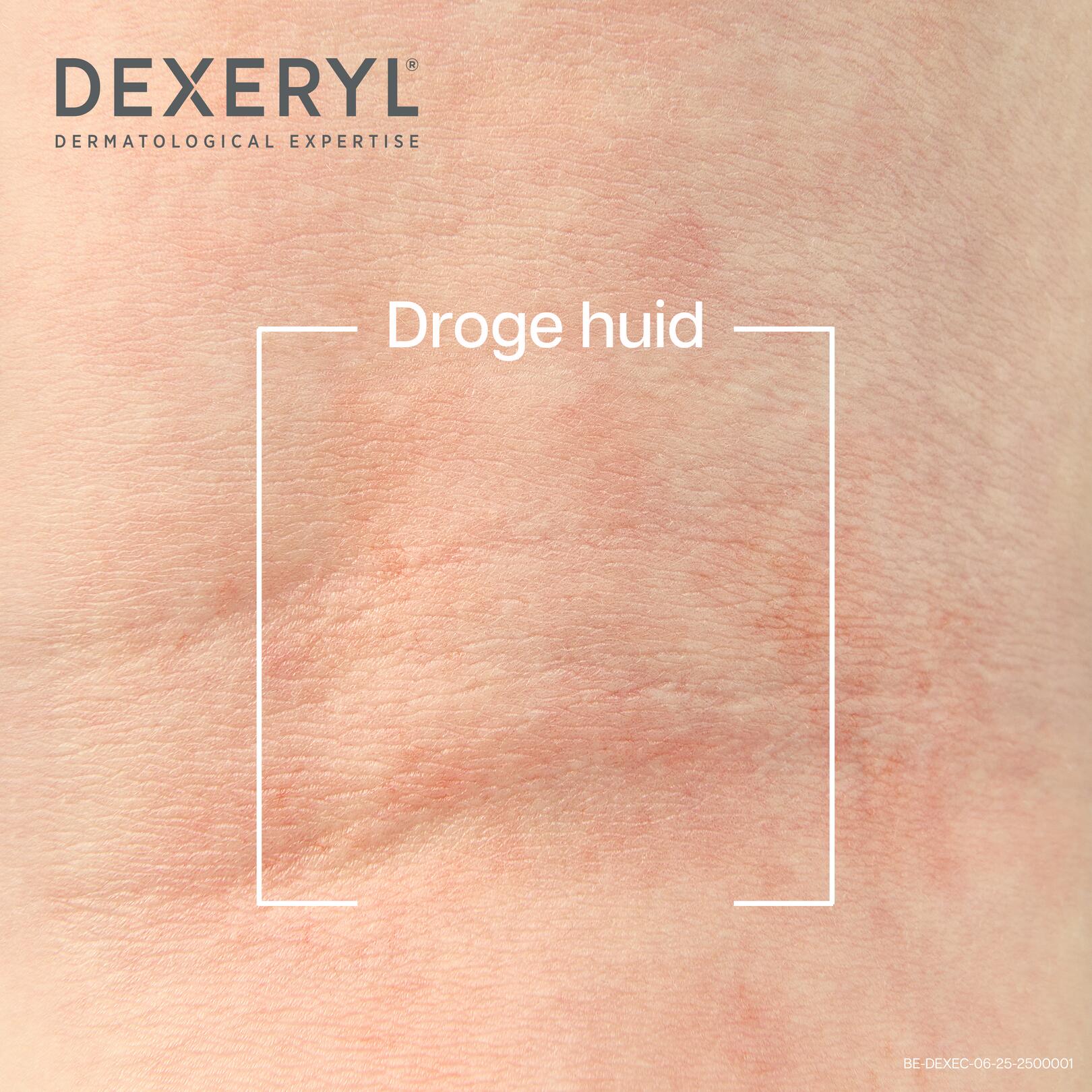 Dexeryl verzachtende crème