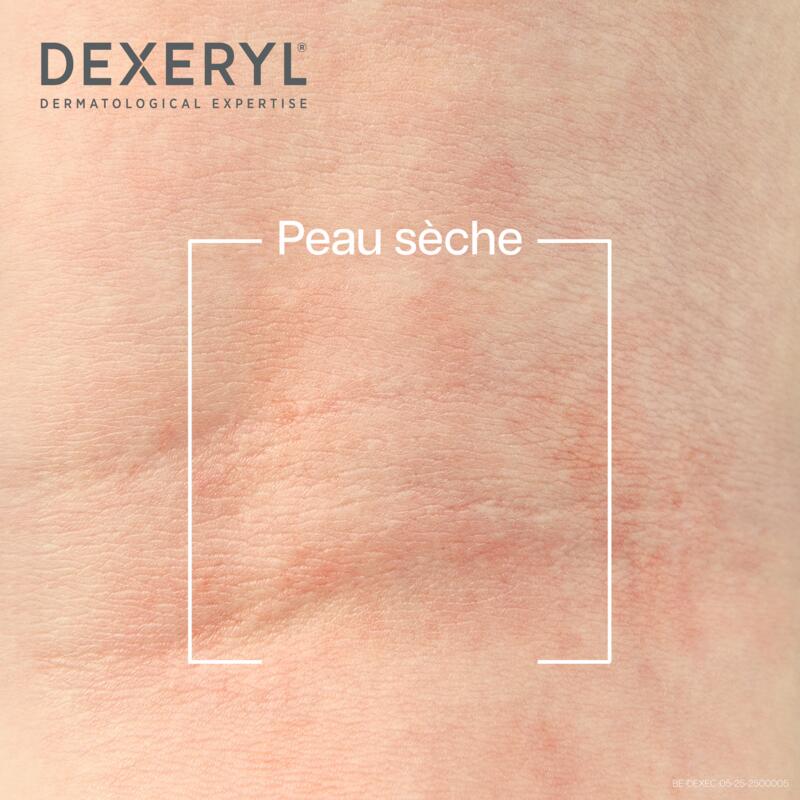 DEXERYL Crème Émolliente