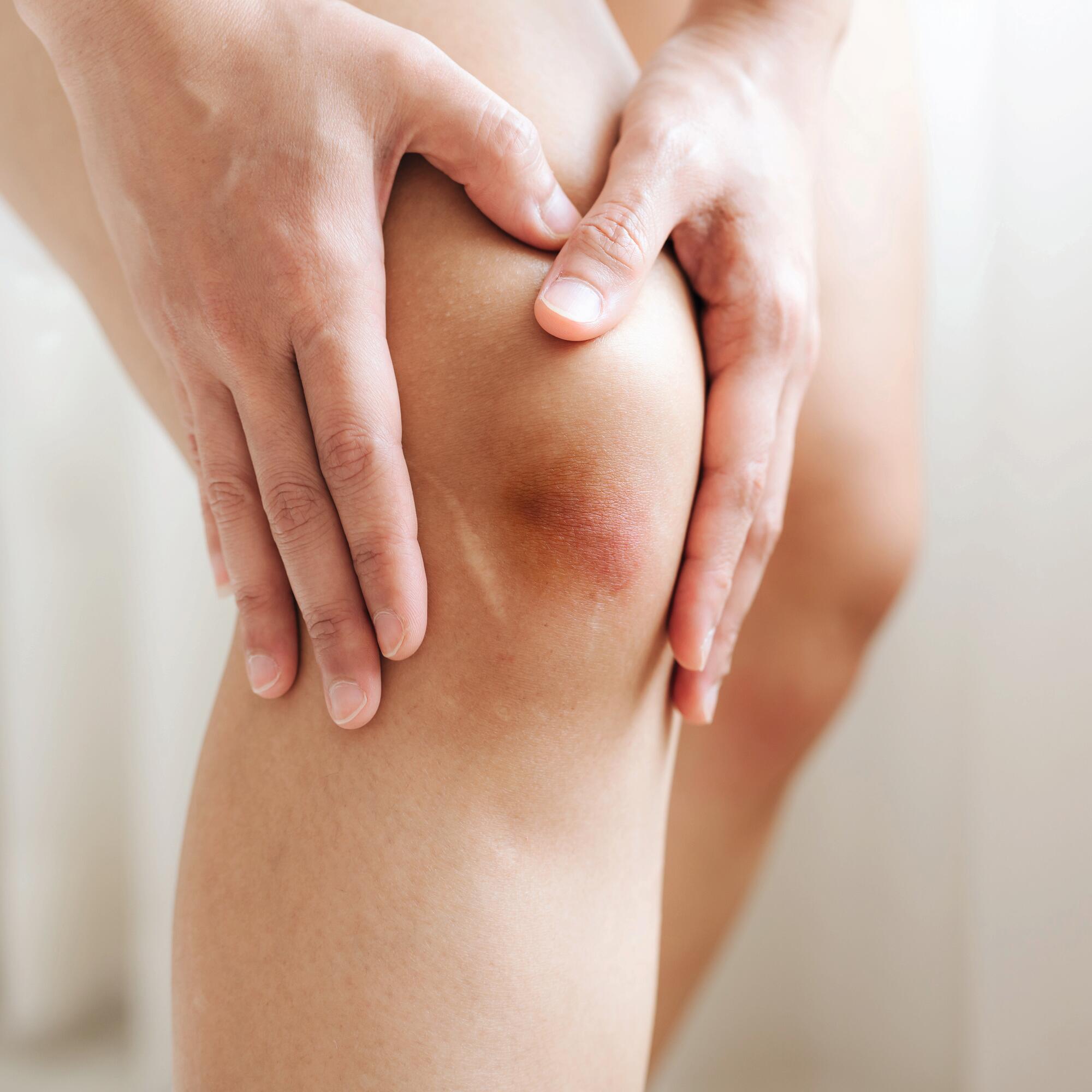 AD_IRRITATIONS_BRUISE-KNEE_SQUARE_2021