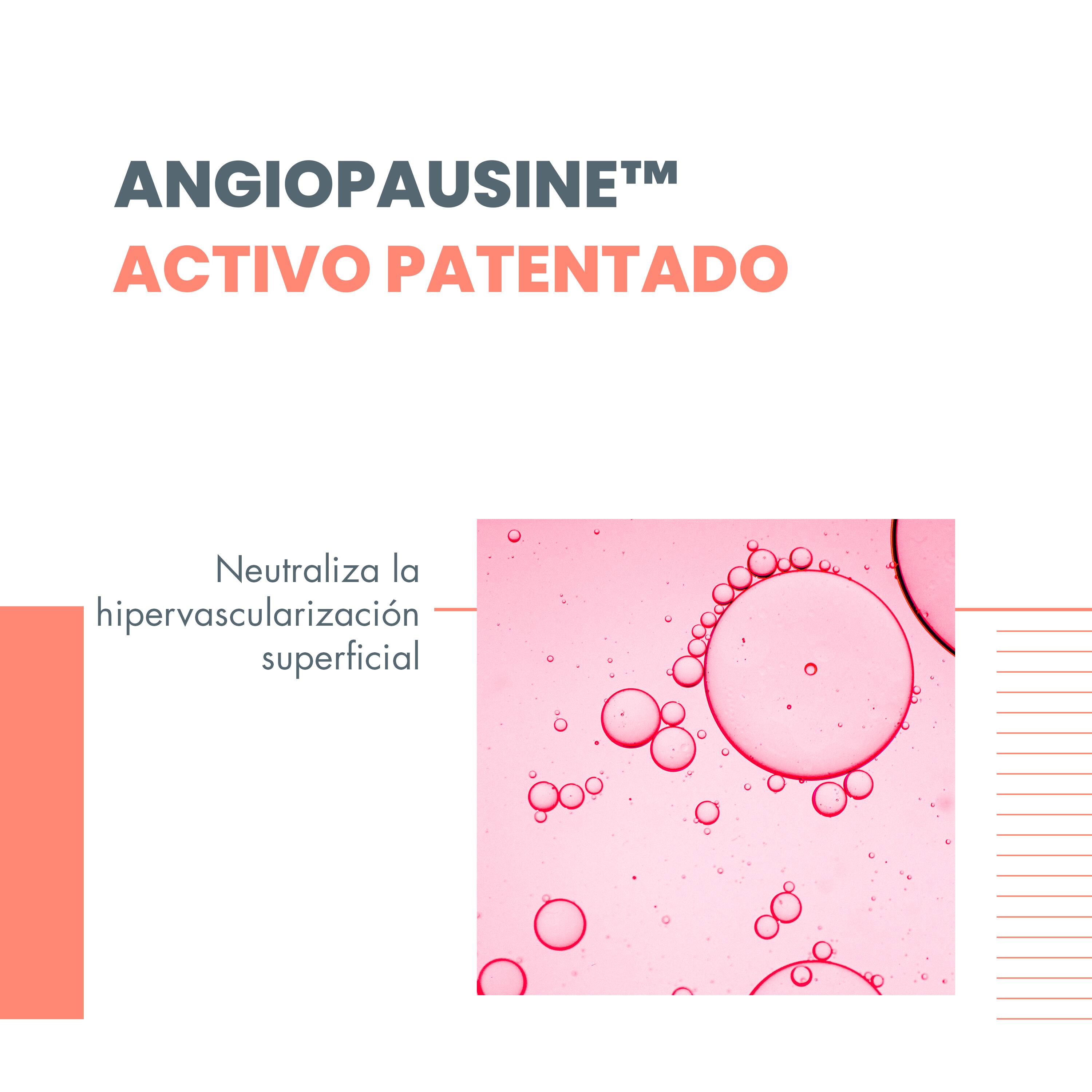 concentrado para rojeces instaladas 