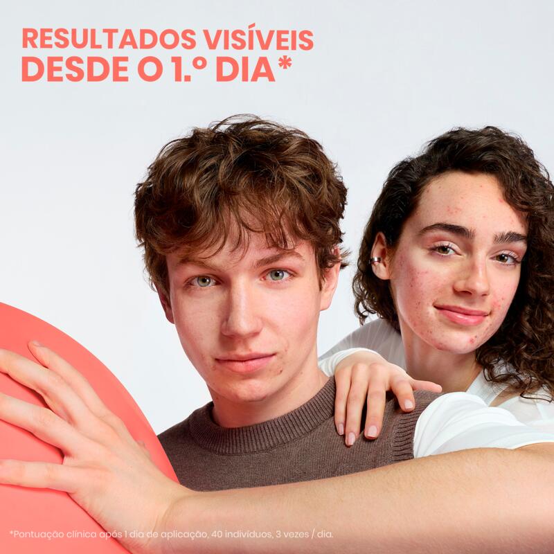 Cleanance COMEDOMED PEELING Creme intensivo para surtos de borbulhas