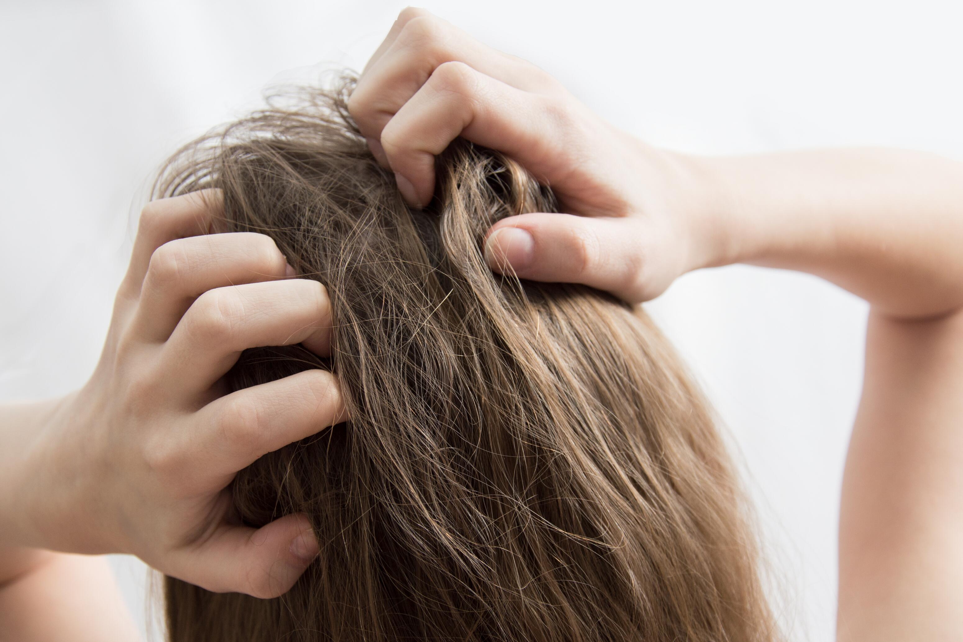 Chute de cheveux due au stress : une chute réactionnelle