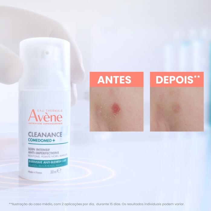 Resultados Cleanance Comedomed+ Cuidado Intensivo Anti-imperfeições