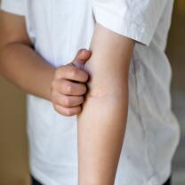 AD_ATOPIE_CHILD-SCRATCHING-ARM_LARGE_2021