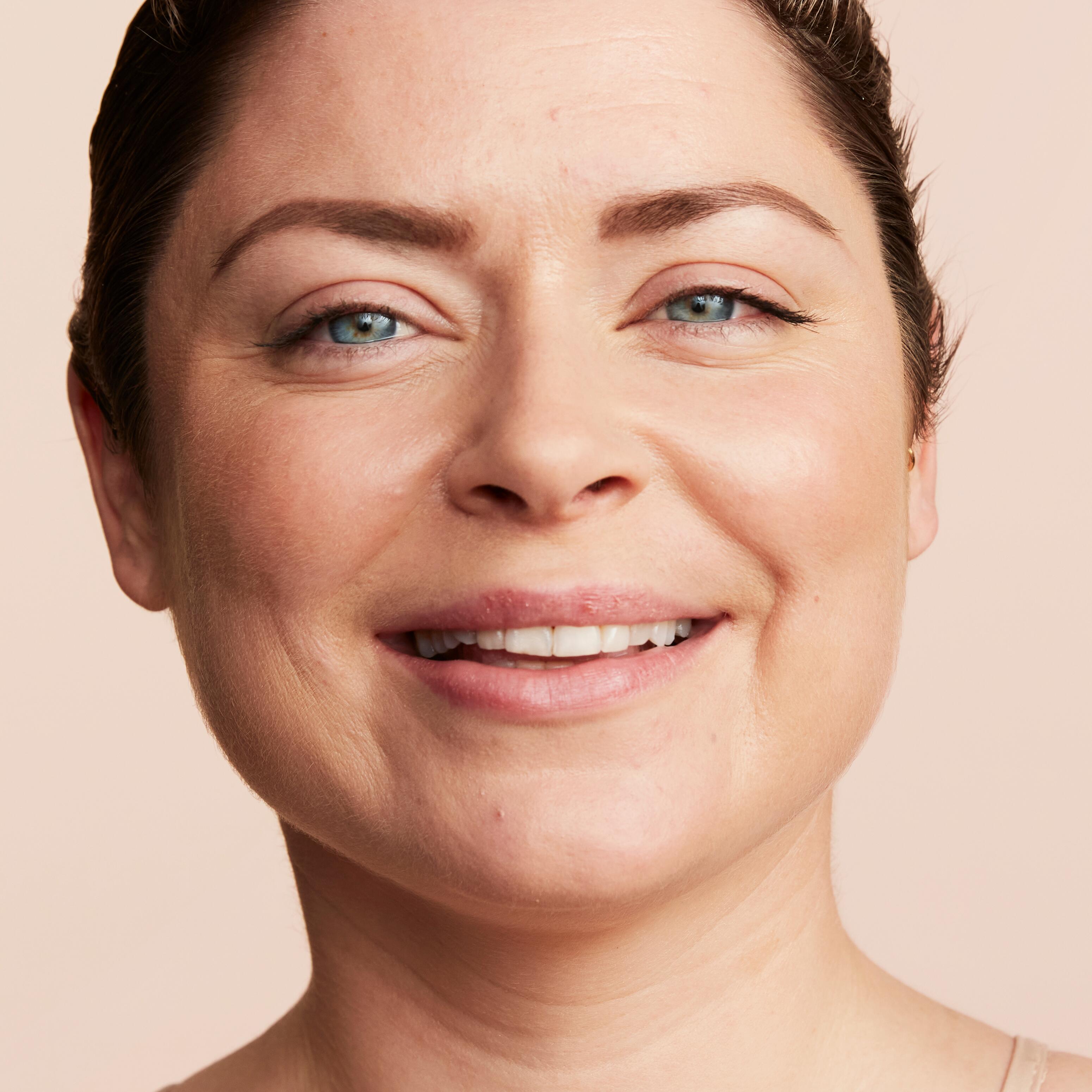 av_couvrance_before-after_pauline-oncology-treatment_after_hd_1-1