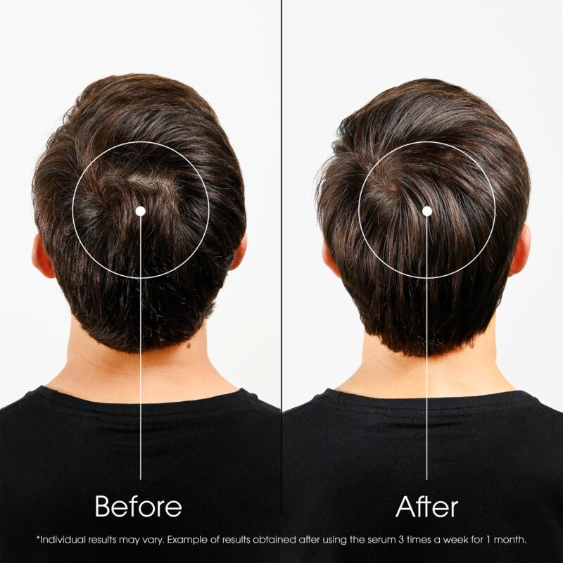 ANTI-HAIR LOSS intense strengthening Serum with Quinine